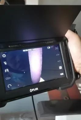 内窥镜轻松地观察到气管是否存在裂缝和沙眼